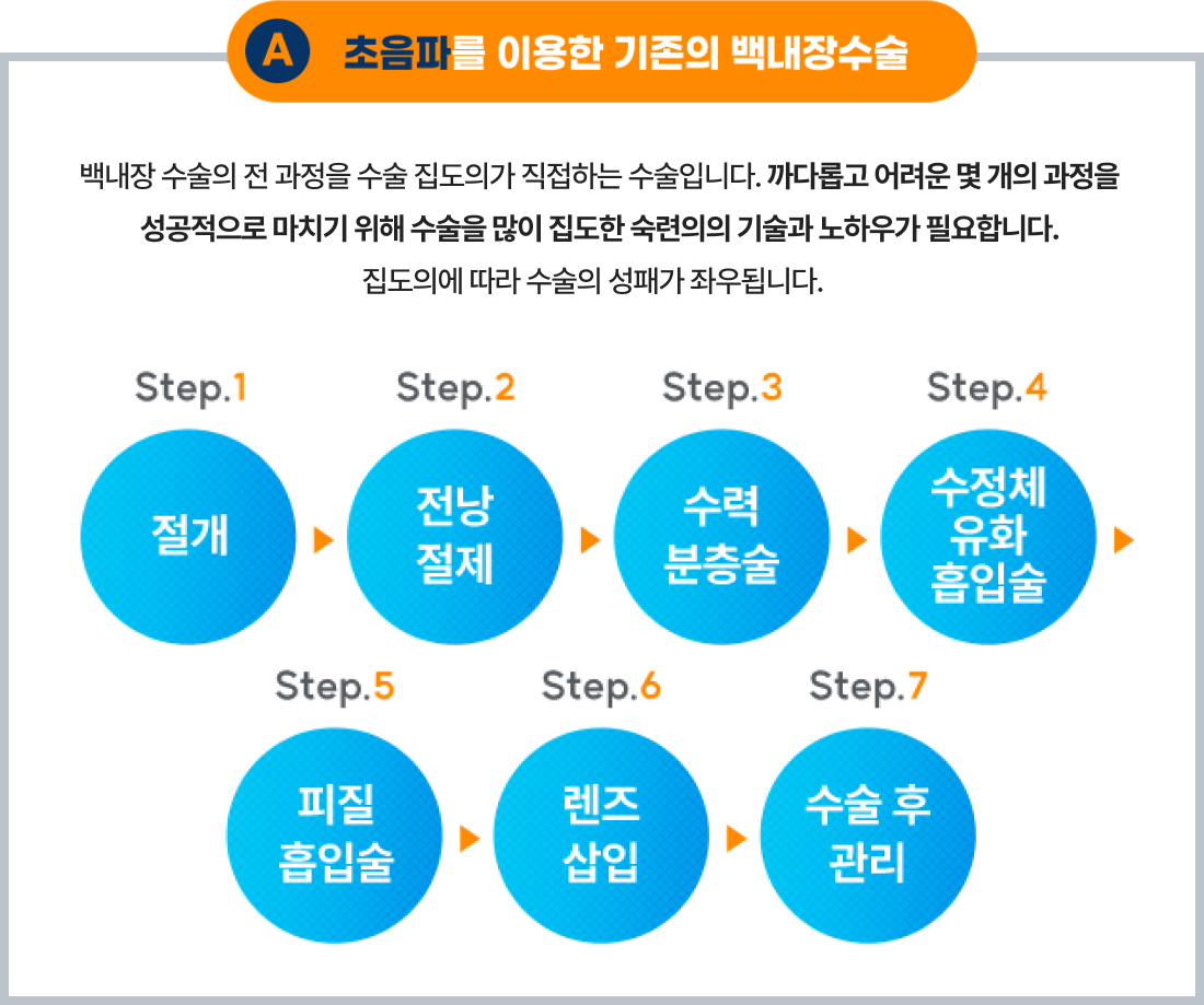 초음파를 이용한 기존의 백내장 수술