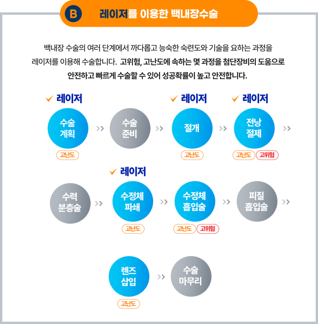초음파를 이용한 기존의 백내장 수술