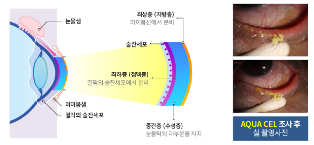 눈물샘