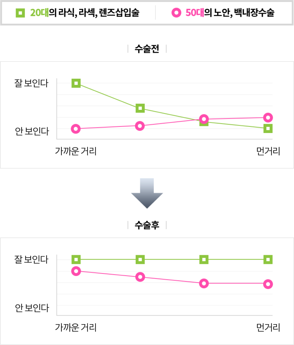 수술 전, 후