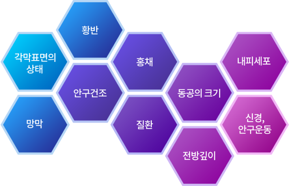 고려해야하는 요인들