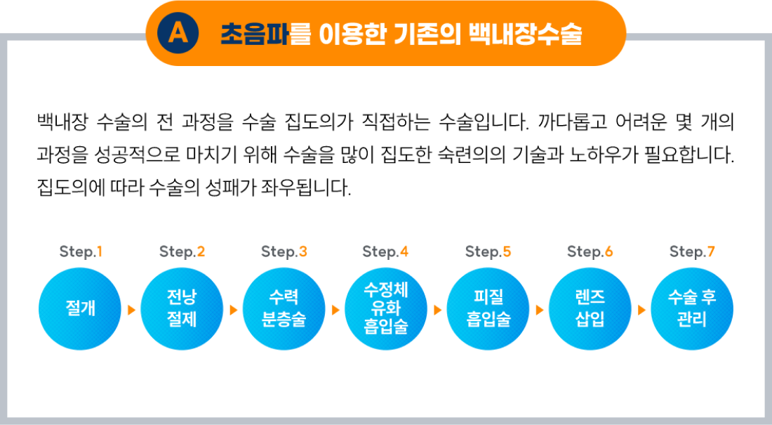 초음파를 이용한 기존의 백내장 수술