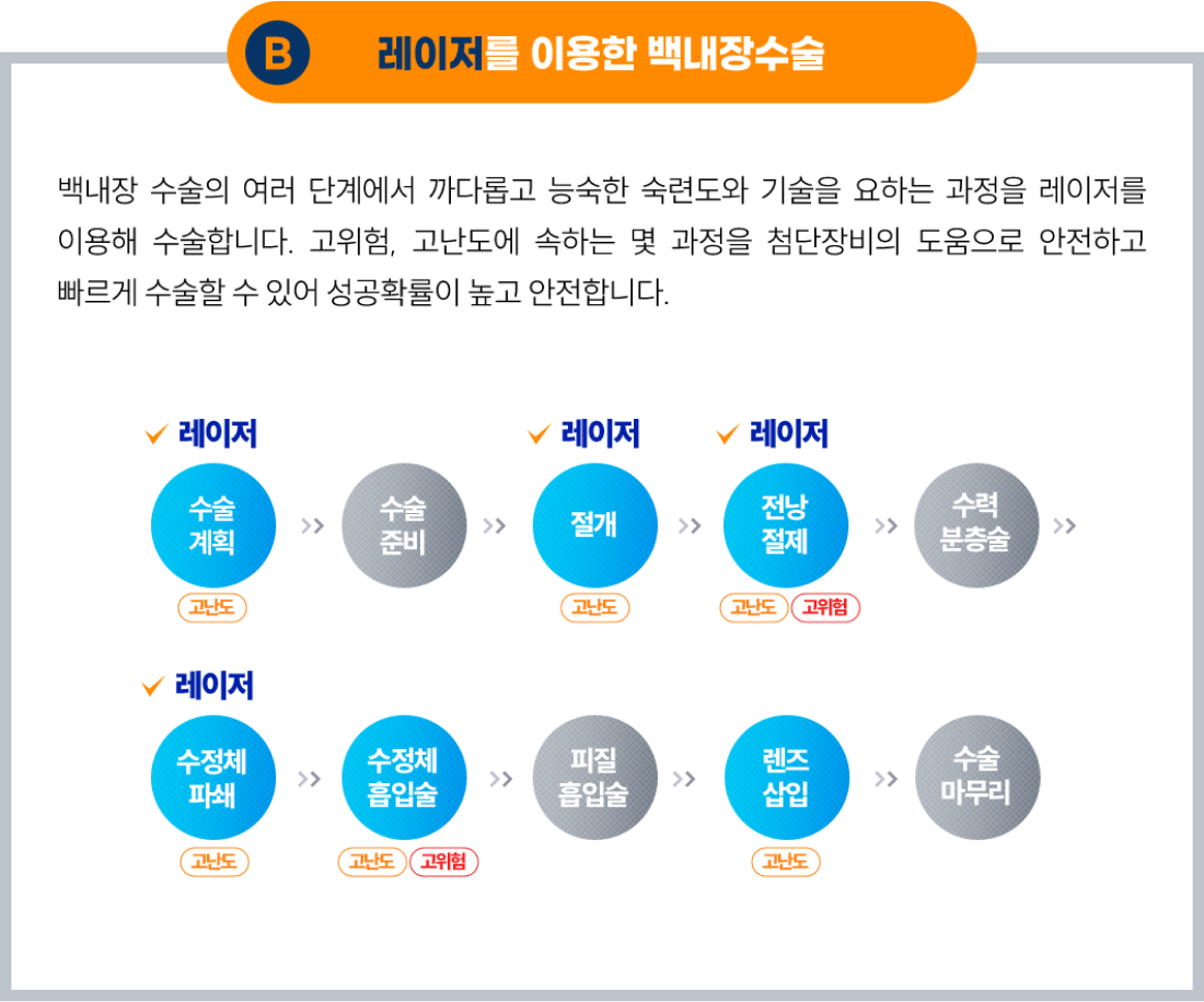 초음파를 이용한 기존의 백내장 수술