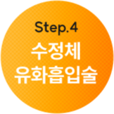 수정체 유화흡입술