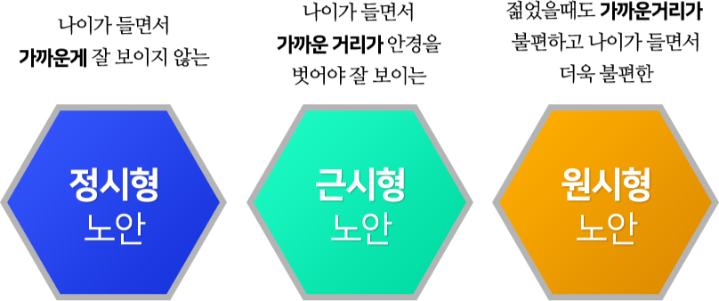 정시형노안, 근시형노안, 원시형노안