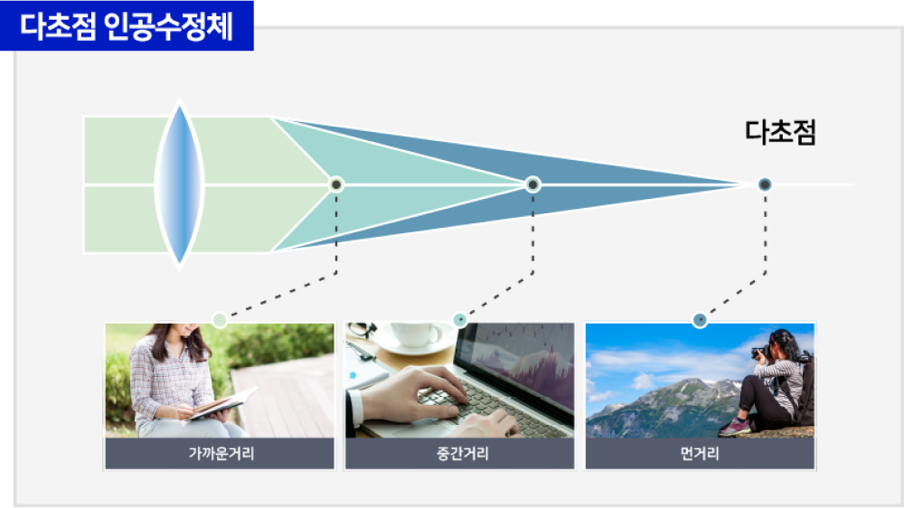 다초점 인공수정체