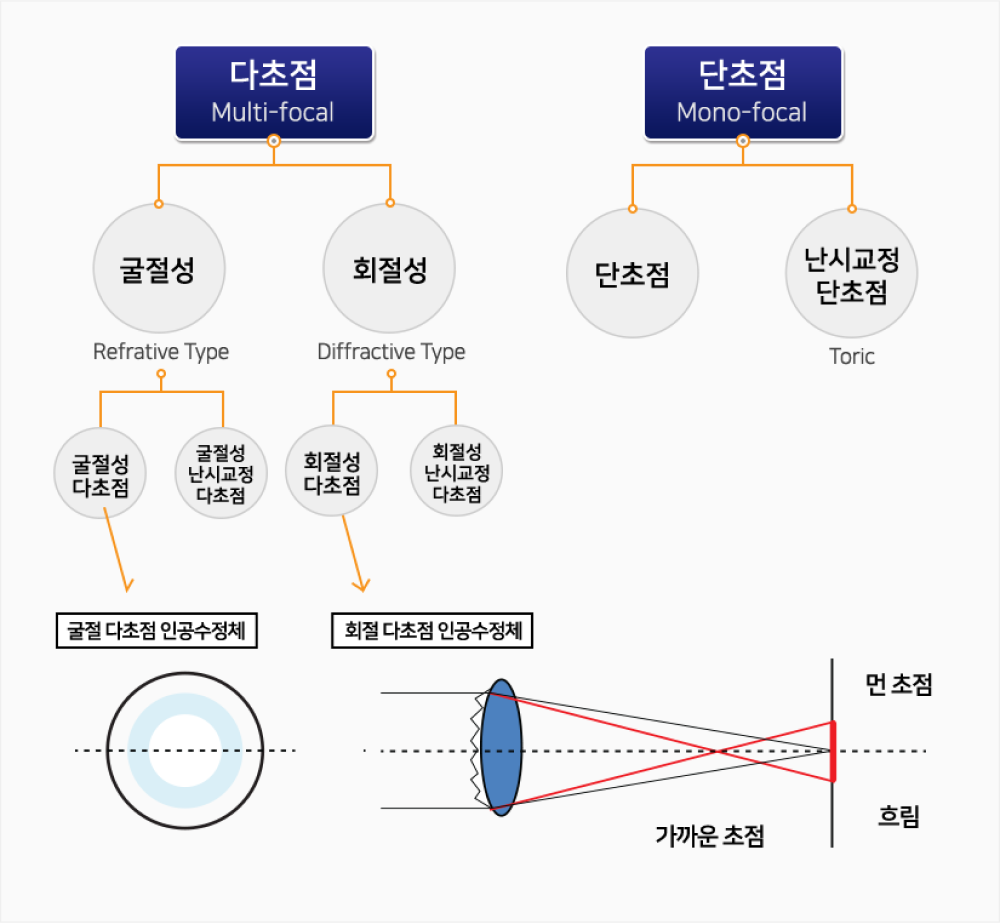 다초점 , 단초점 설명