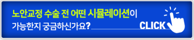 시뮬레이션