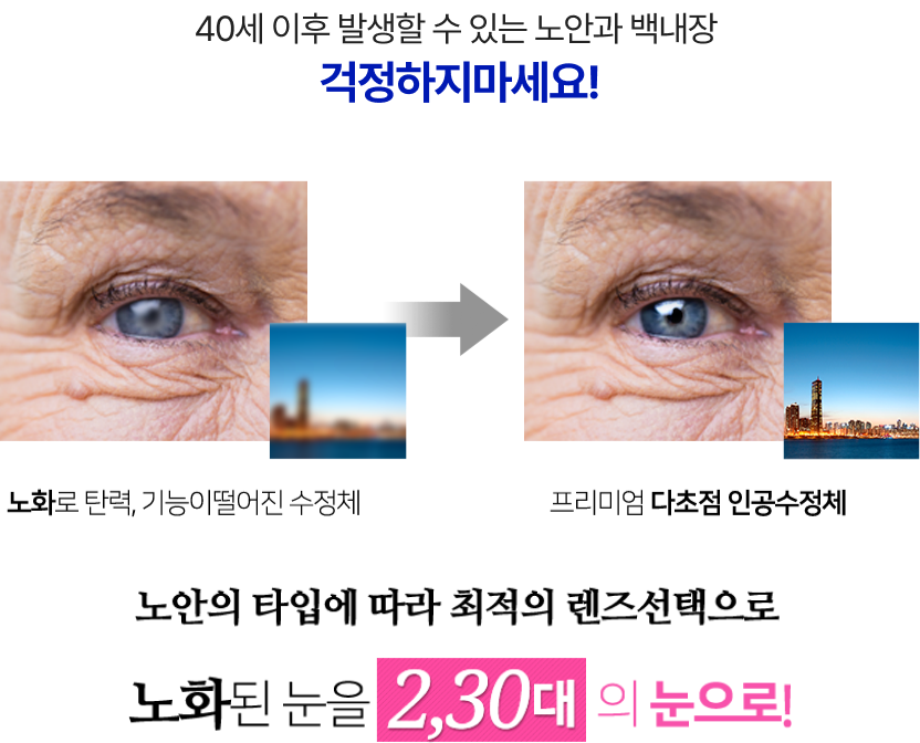 노화된 눈을 2,30대의 눈으로!