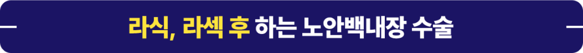 라식 라섹 후 하는 노안백내장 수술