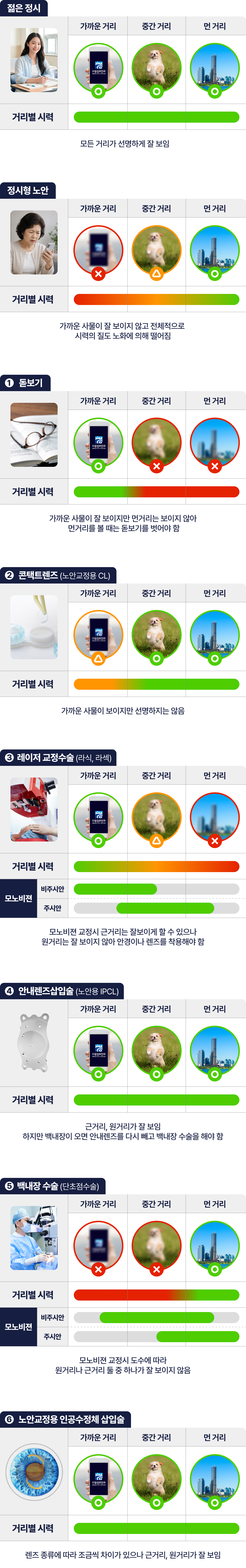 정시형 노안 내용