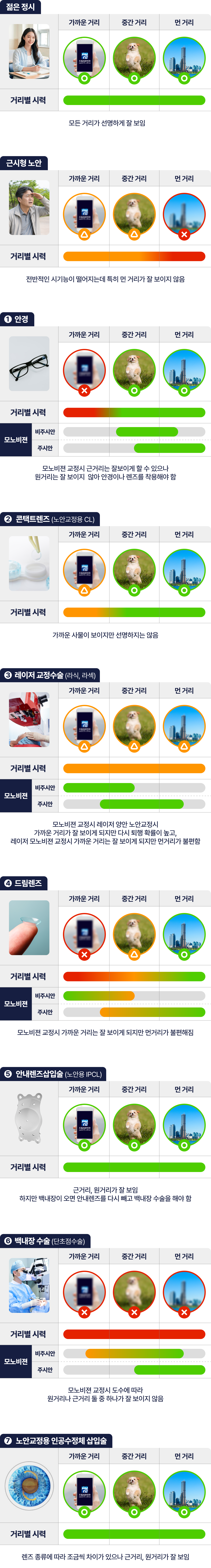 근시형 노안 내용