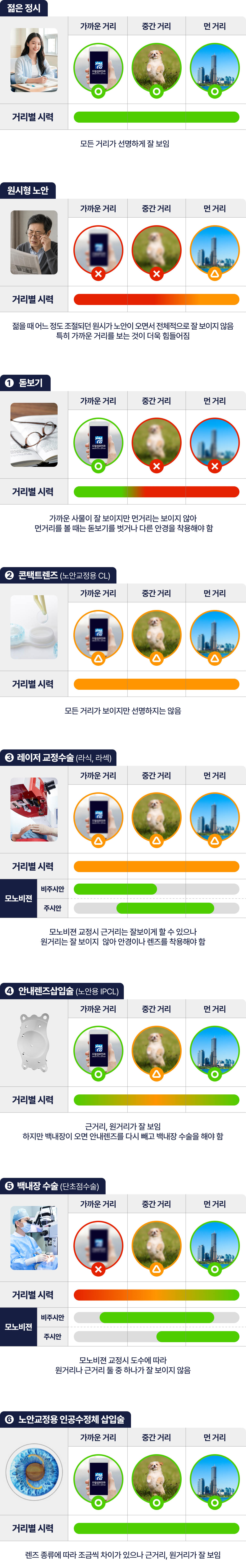 원시형 노안 내용