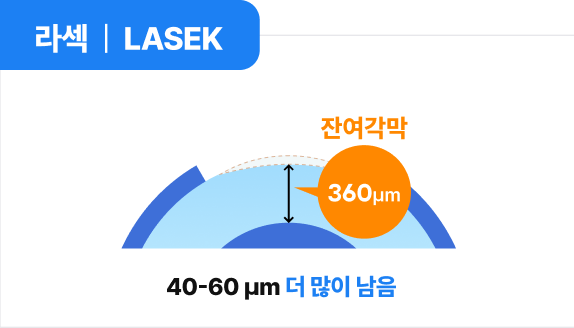 라섹 | LASEK