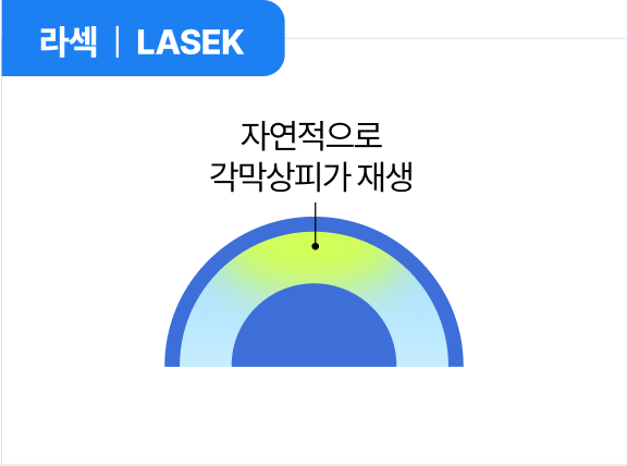 라섹 | LASEK