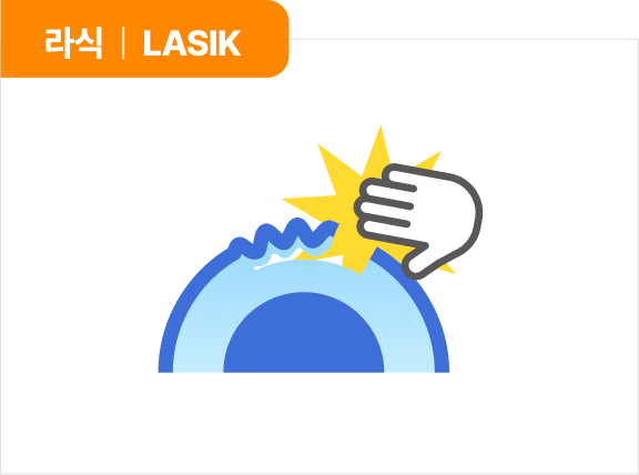 라식 | LASIK